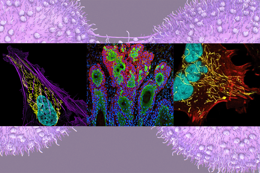 Tres pantallas con imágenes microscópicas coloridas de células tumorales usadas para ilustrar nuevos modelos de cáncer derivados de pacientes