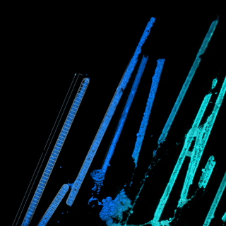 Micrografía del estudio que muestra oligodendrocitos y vainas de mielina sobre microfibras de distintos diámetros.