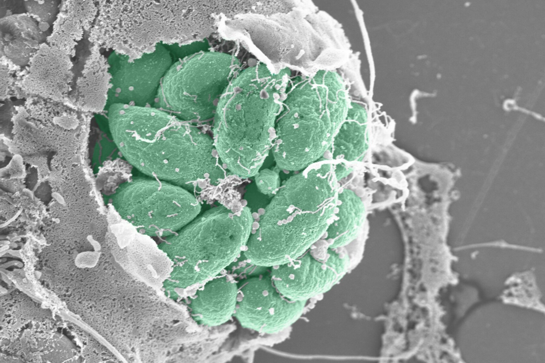 Micrografía electrónica de parásitos Toxoplasma saliendo de una célula infectada, coloreados en verde.