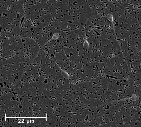 Micrografía de espermatozoides humanos observados a gran aumento.