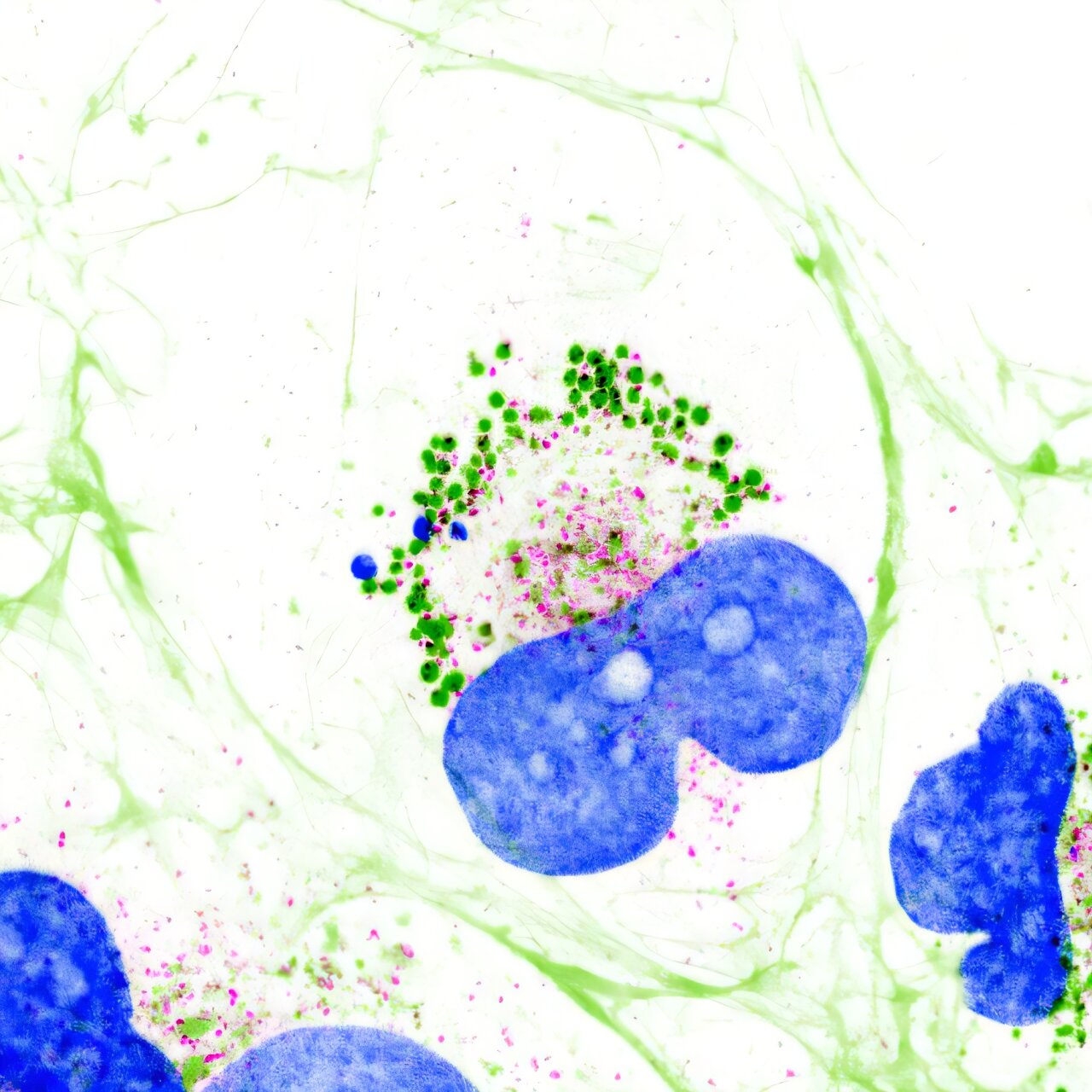 Células hepáticas humanas con gotas de colágeno en verde dentro de la célula y núcleos teñidos de azul