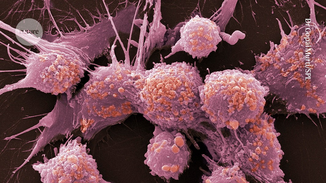 Ilustración editorial original con el título “Una nueva revisión sugiere que el test PSA sí podría reducir muertes por cáncer de próstata” y una composición abstracta asociada a Medicina.