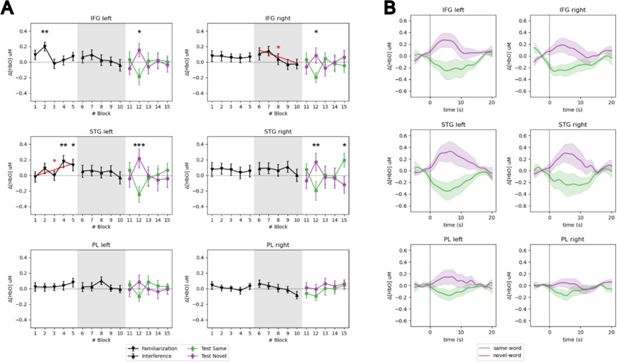 Esquema del montaje de espectroscopia funcional y del experimento usado para medir cómo recién nacidos distinguen palabras y voces.