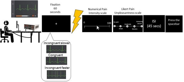 Diagrama experimental del estudio que compara latidos acelerados o lentos y su efecto sobre la percepción del dolor