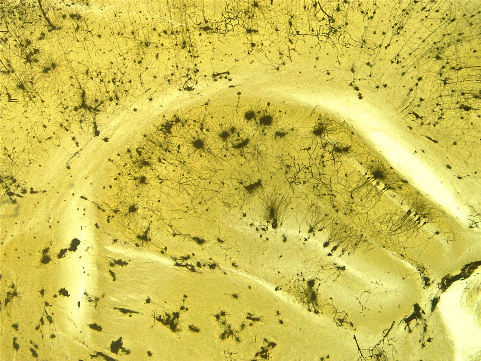 Neuronas del hipocampo teñidas observadas al microscopio.