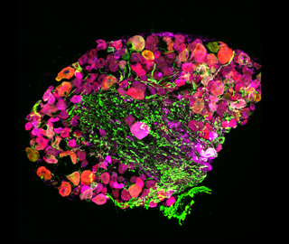 Micrografía fluorescente multicolor de un ganglio neuronal sobre fondo negro.