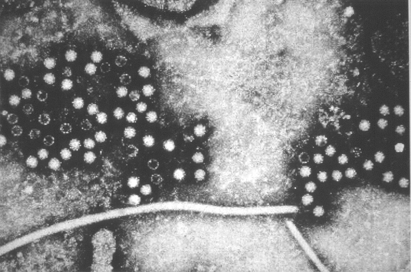 Micrografía electrónica de partículas del virus de la hepatitis E.
